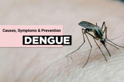 Dengue Fever Causes, Symptoms, and Prevention